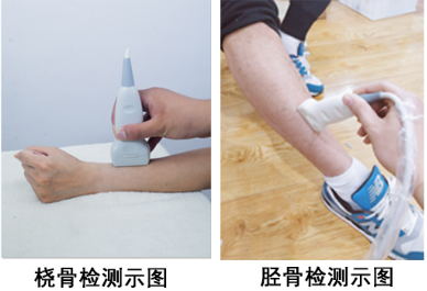 骨密度仪生产厂家介绍检测身体这个部位能够准确检测身体骨密度含量