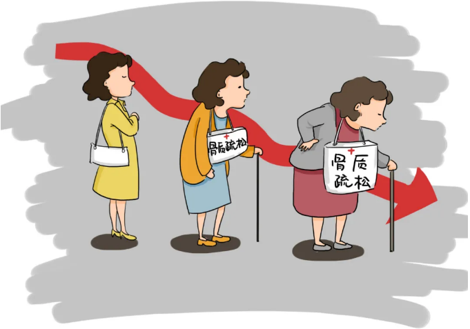 骨密度测试报告的SOS值是多少?最新开云APP
教你清楚地报告你的骨密度 骨密度测试报告的SOS值是多少?最新开云APP
教你清楚地报告你的骨密度