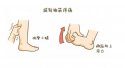 619国康超声骨密度仪厂家关注：小腿抽筋怎么办？一定是缺钙吗？