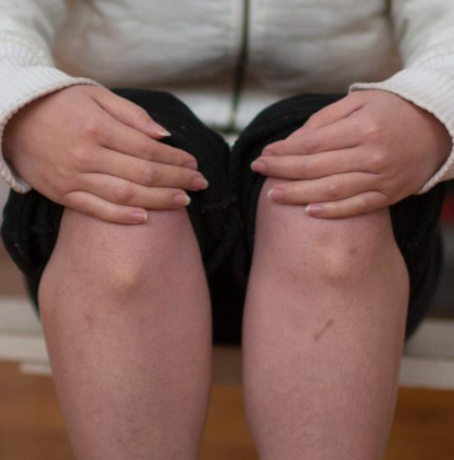 儿童骨密度检测仪厂家属于什么设备要真怎么查你想了解的问题听听医生怎么说